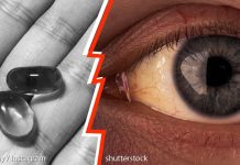 ქალი ძალიან ბევრ ვიტამინს იღებდა, რაც მას ღვიძლის ტოლფასი დაუჯდა