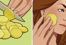 ის ყოველდღე სახეს კარტოფილის ნაჭრებით იწმენდს, გამიკვირდა მიზეზი რომ გავიგე.